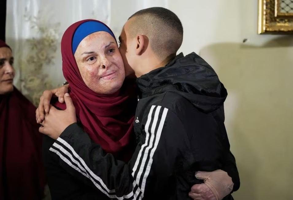 Released Palestinian prisoner Israa Jaabis is received by her family in her house in Jerusalem, amid a hostages-prisoners swap deal between Hamas and Israel, November 26, 2023.